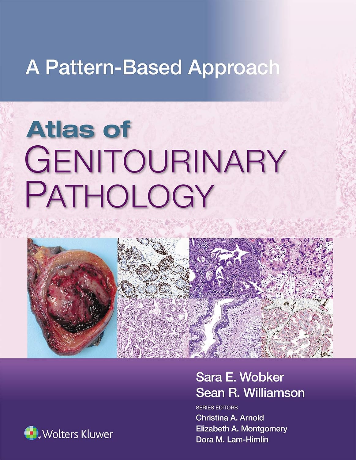 Atlas of Genitourinary Pathology: A Pattern Based Approach