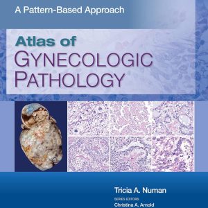 Atlas of Gynecologic Pathology: A Pattern-Based Approach