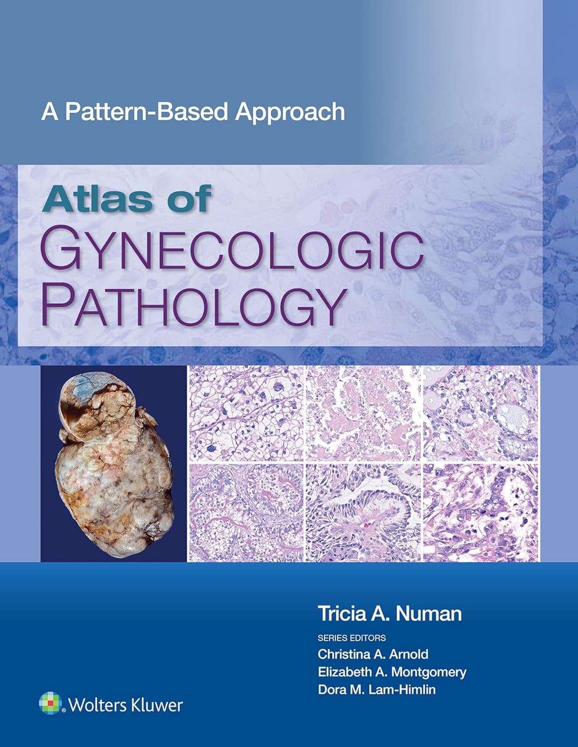 Atlas of Gynecologic Pathology: A Pattern-Based Approach