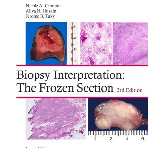 Biopsy Interpretation: The Frozen Section 3rd Edition