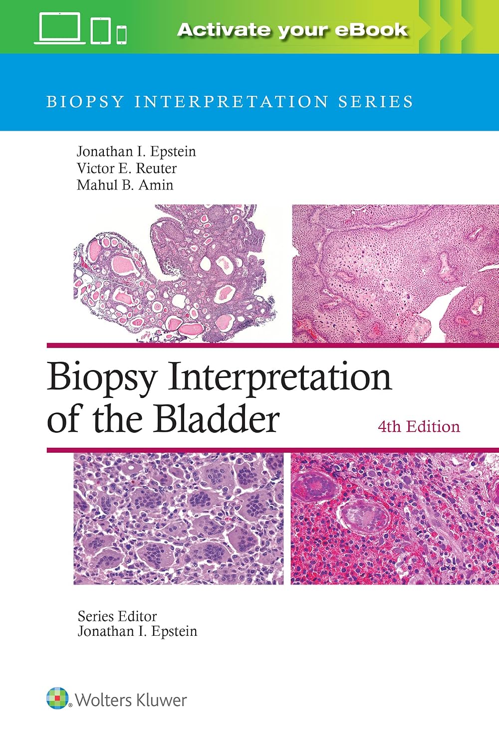 Biopsy Interpretation of the Bladder 4th Edition