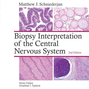 Biopsy Interpretation of the Central Nervous System 2nd Edition