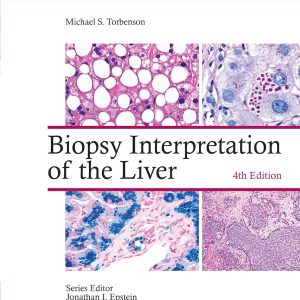 Biopsy Interpretation of the Liver 4th Edition