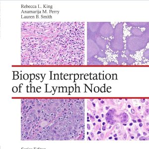 Biopsy Interpretation of the Lymph Nodes