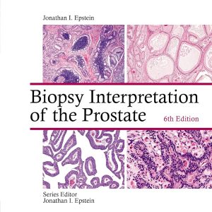 Biopsy Interpretation of the Prostate 6th Edition