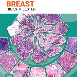 Diagnostic Pathology: Breast 4th Edition