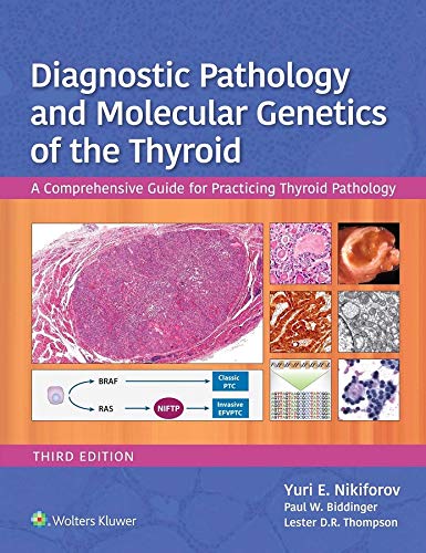 Diagnostic Pathology and Molecular Genetics of the Thyroid A Comprehensive Guide for Practicing Thyroid Pathology 3rd Edition