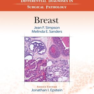 Differential Diagnoses in Surgical Pathology Breast