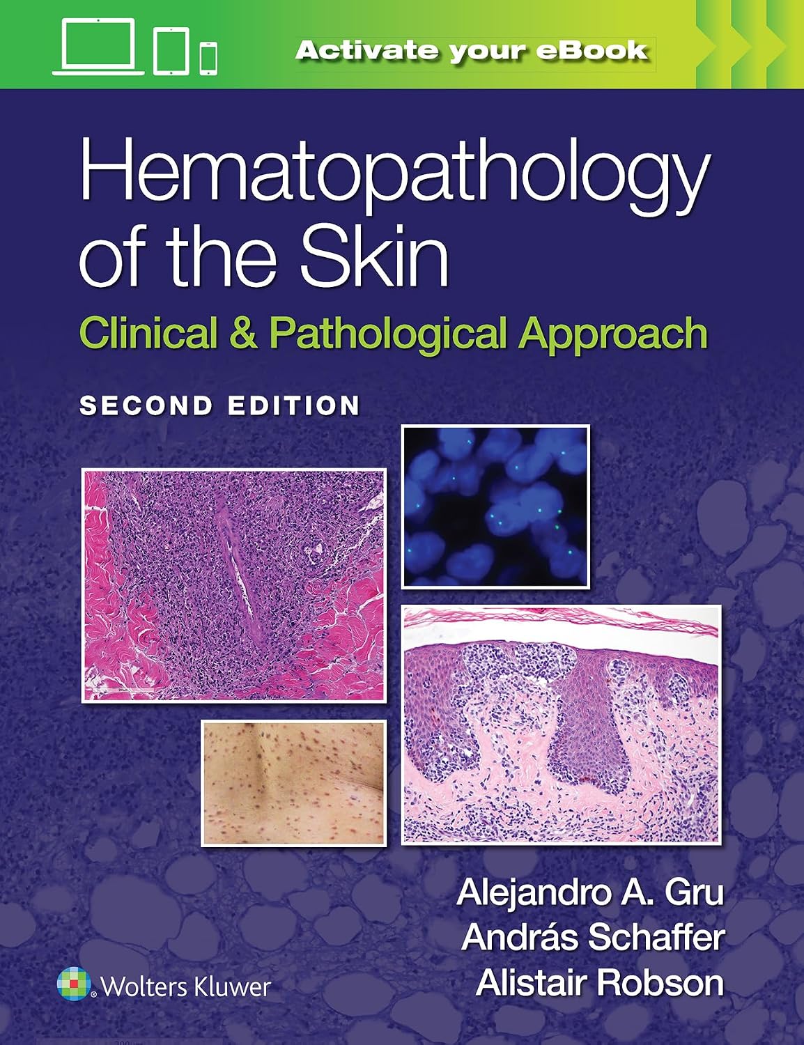 Hematopathology of the Skin: Clinical & Pathological Approach 2nd Edition