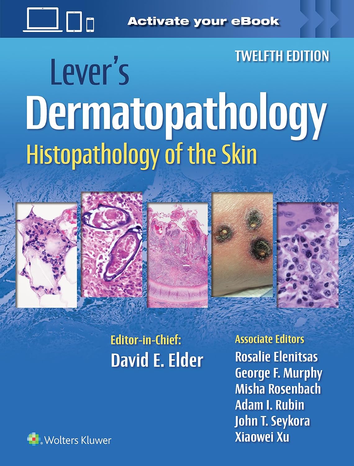 Lever's Dermatopathology: Histopathology of the Skin 12th Edition