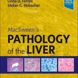 MacSween's Pathology of the Liver 8th Edition