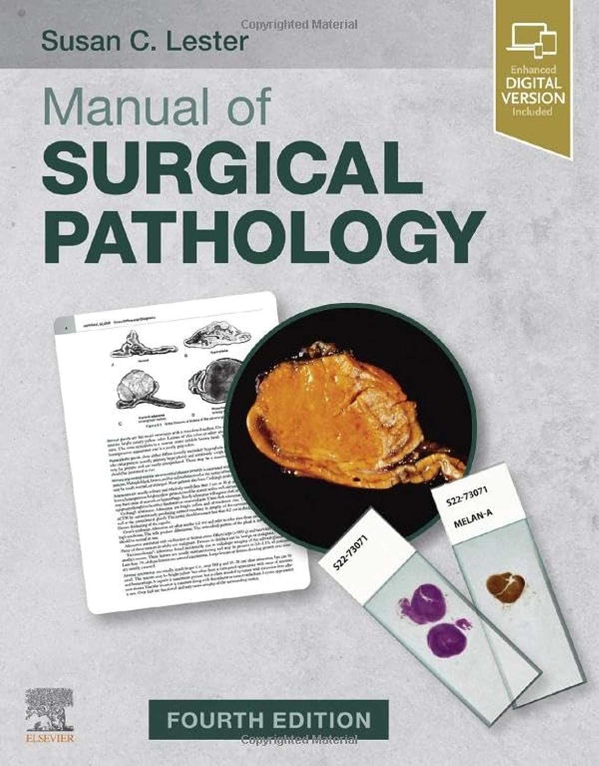 Susan C. Lester Manual of Surgical Pathology 4th Edition