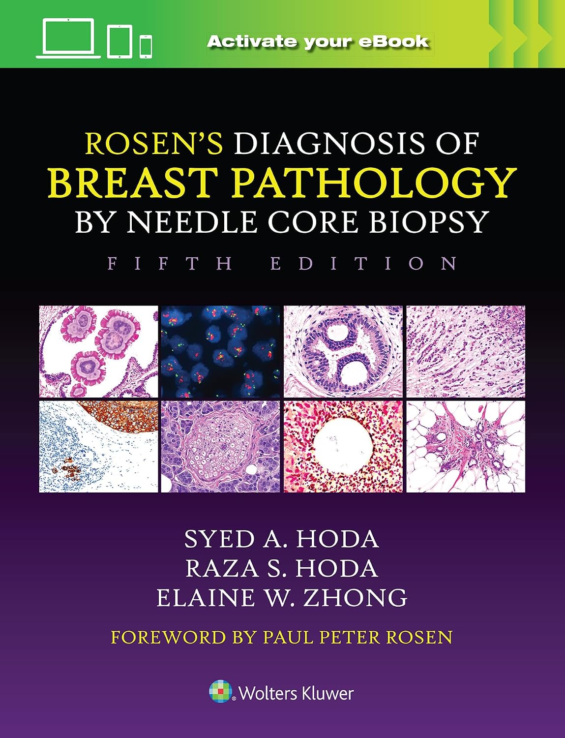 Rosen's Diagnosis of Breast Pathology by Needle Core Biopsy 5th Edition
